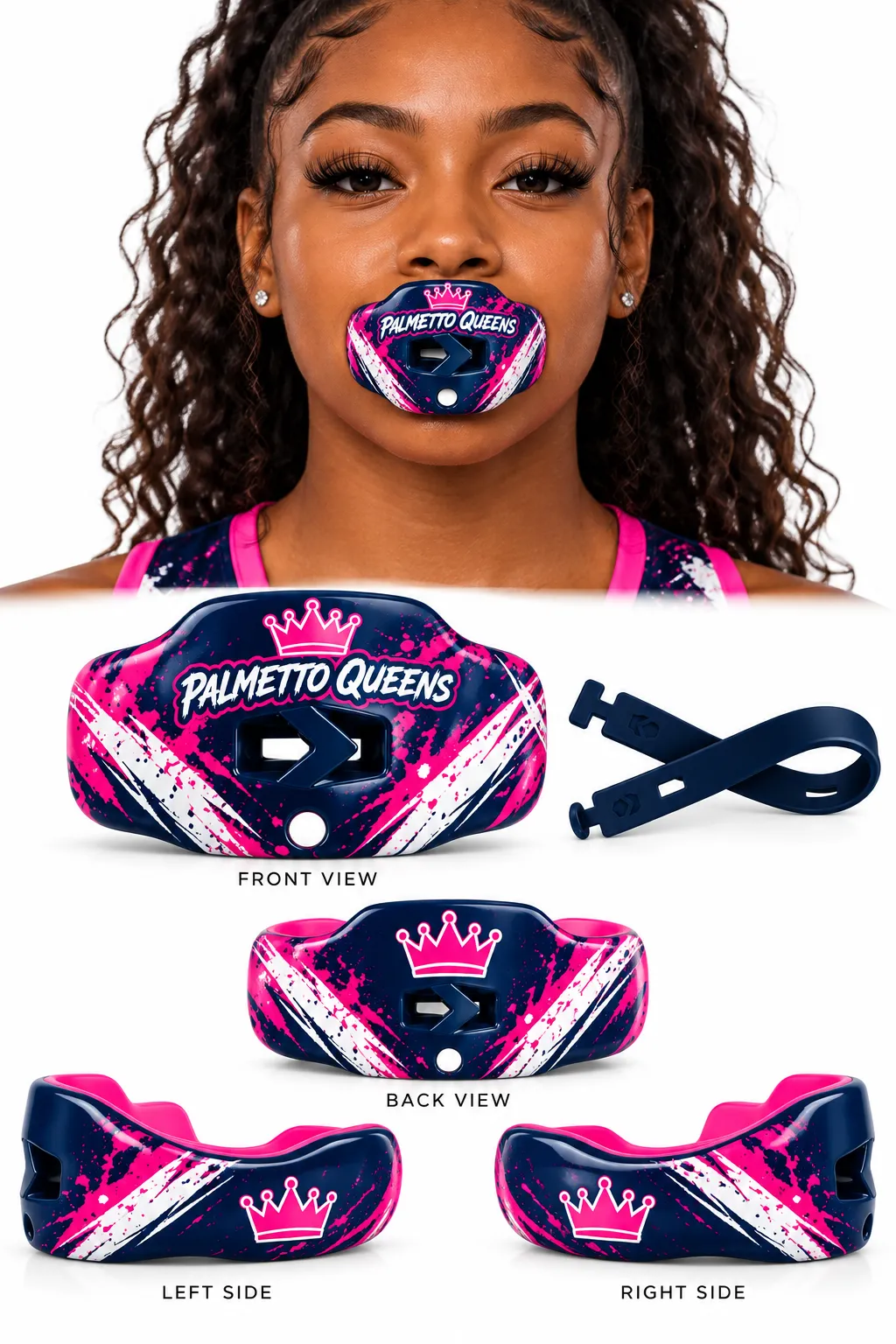 Queens Mouthpiece